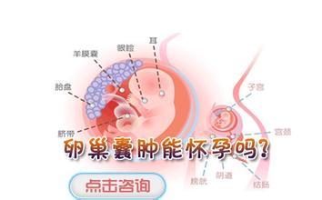 卵巢囊肿有哪些类型