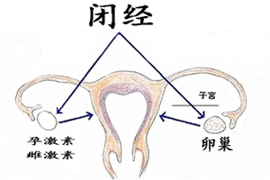 女性闭经前的症状有哪些