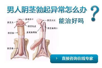 阴茎勃起异常是怎么回事