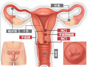 女性患宫颈糜烂的原因有哪些